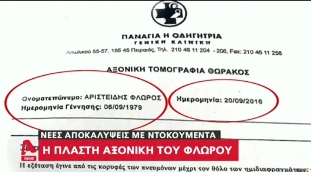 Αποκάλυψη! Αυτό είναι το πλαστό έγγραφο αξονικής τομογραφίας του Άρη Φλώρου (βίντεο)